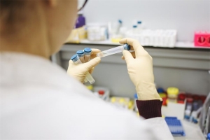 Kriteriji za testiranje na SARS-CoV-2, prekid izolacije i karantene