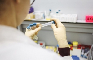 Prioriteti za testiranje na SARS-CoV-2, postupanje s kontaktima te prekid izolacije i karantene